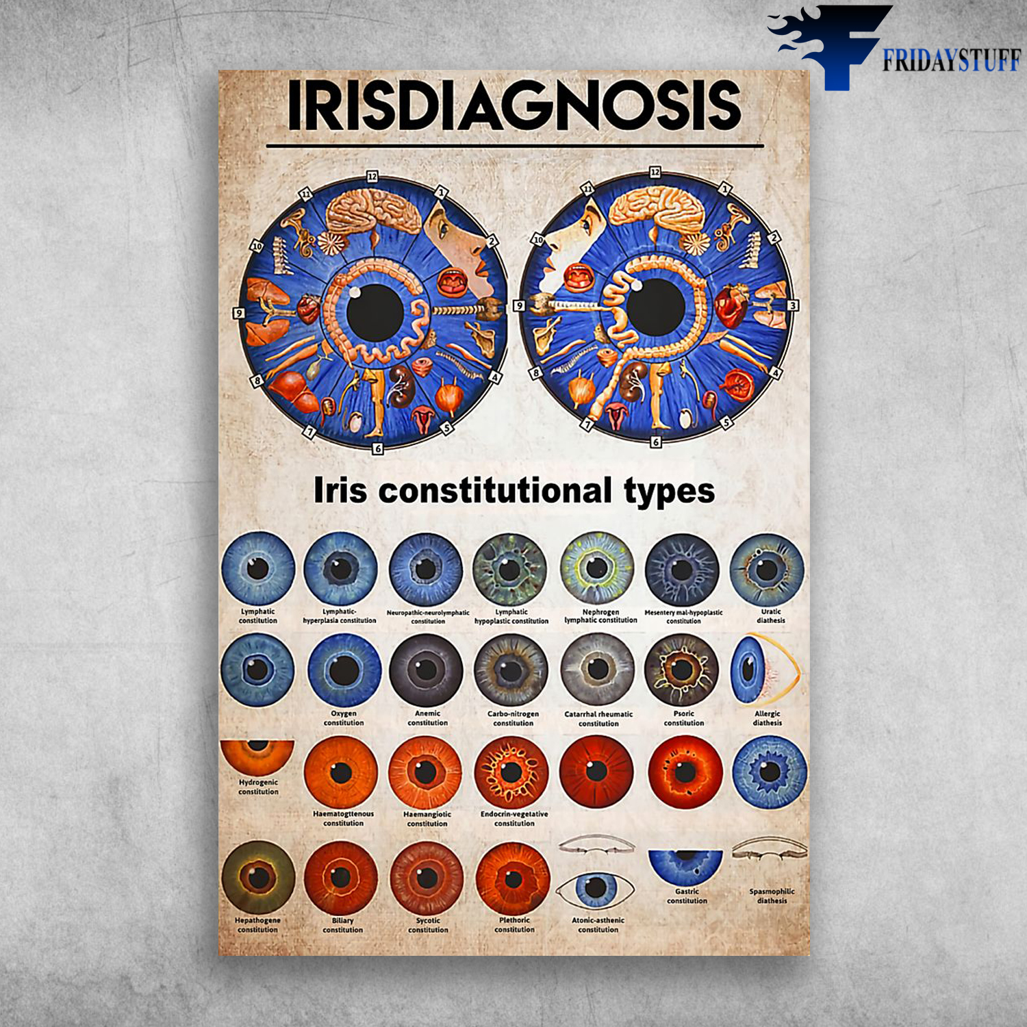 Irisdiagnosis Iris Constitutional Types Optometrist Community