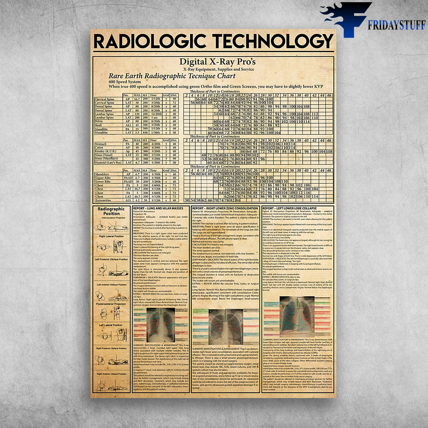 Radiologic Technology Digital X Ray Pro's Rare Earth Radiographic Techique Chart
