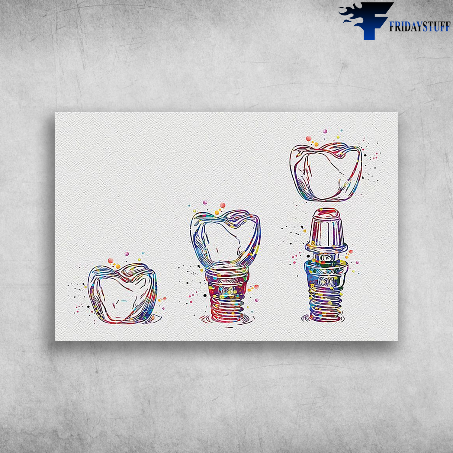 Dentist Implant - The Process Of Implanting A Colorful Denture