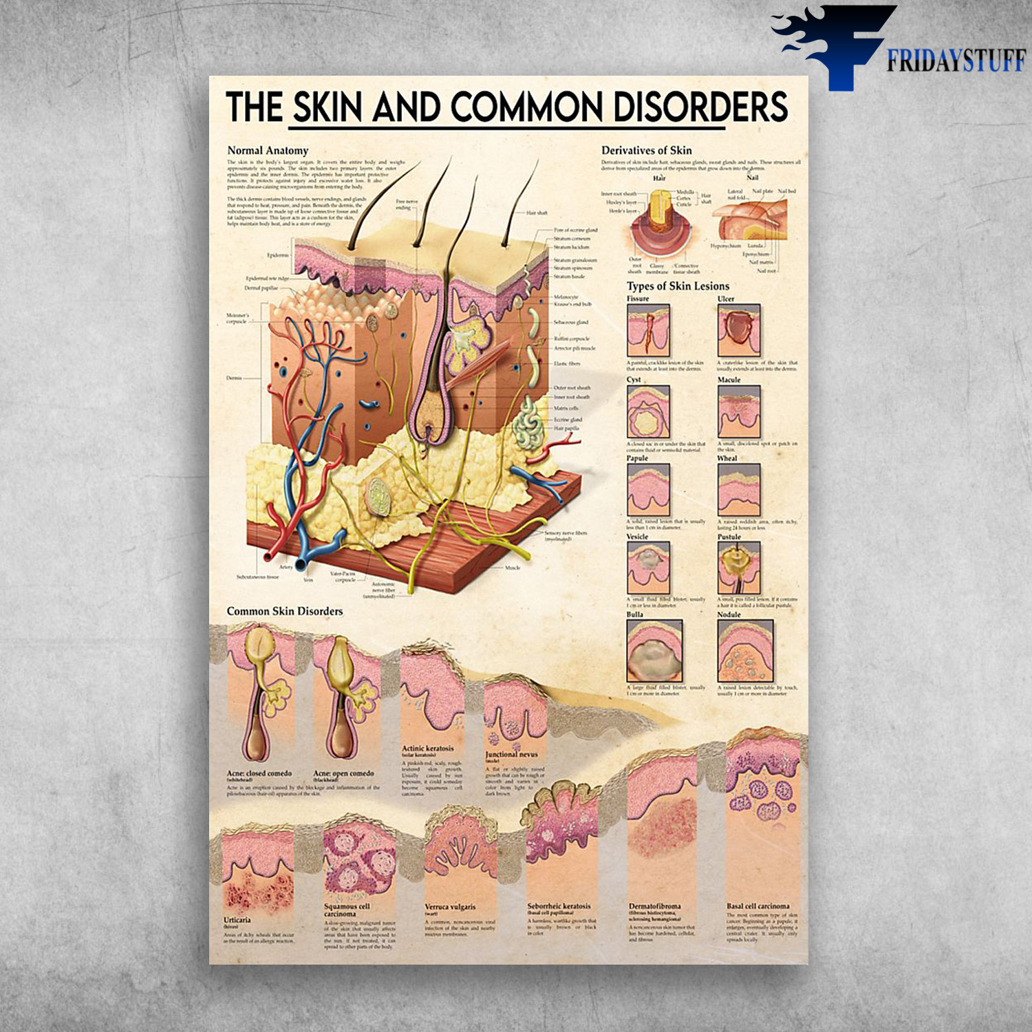 The Skin And Common Disorders, Normal Anatomy, Derivatives Of Skin, Common Skin Disorders