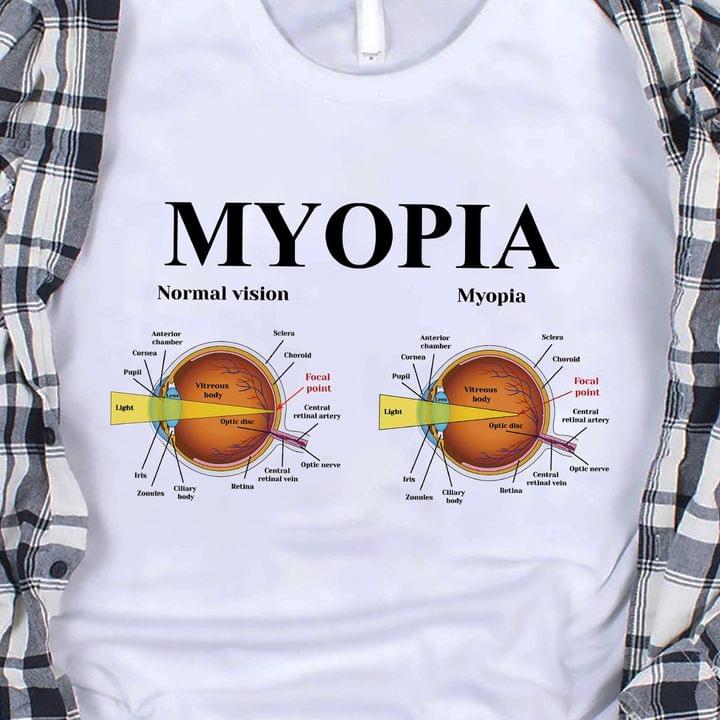 Myopia normal vision versus myopia - Eye ball