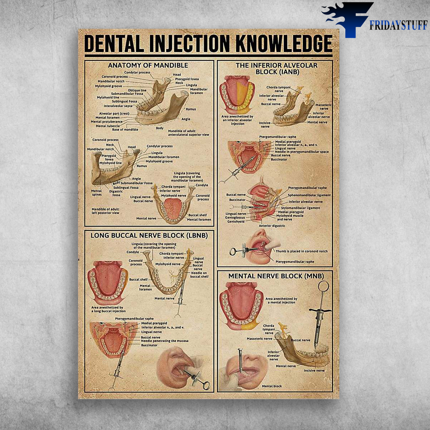 Dental Injection Knowledge - Anatomy Of Mandible, The Inferior Alveolar Block, Long Buccal Nerve Block, Mental Nerve Block