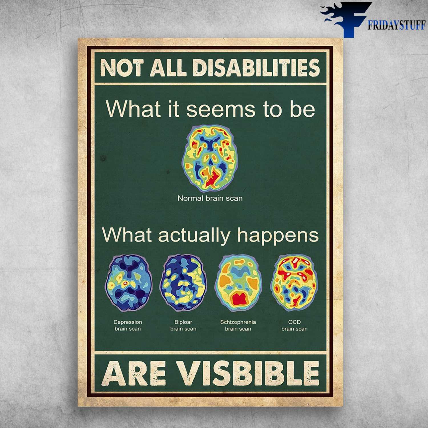 Brian Scan - Not All Disabilities, What It Seems To Be Normal Brain Scan, What Actually Happens, Are Visbible