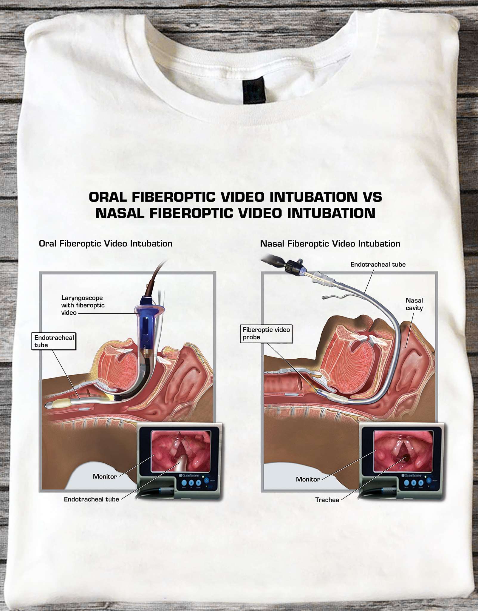 Oral fiberoptic video intubation, nasal fiberoptic video intubation, endotracheal tube