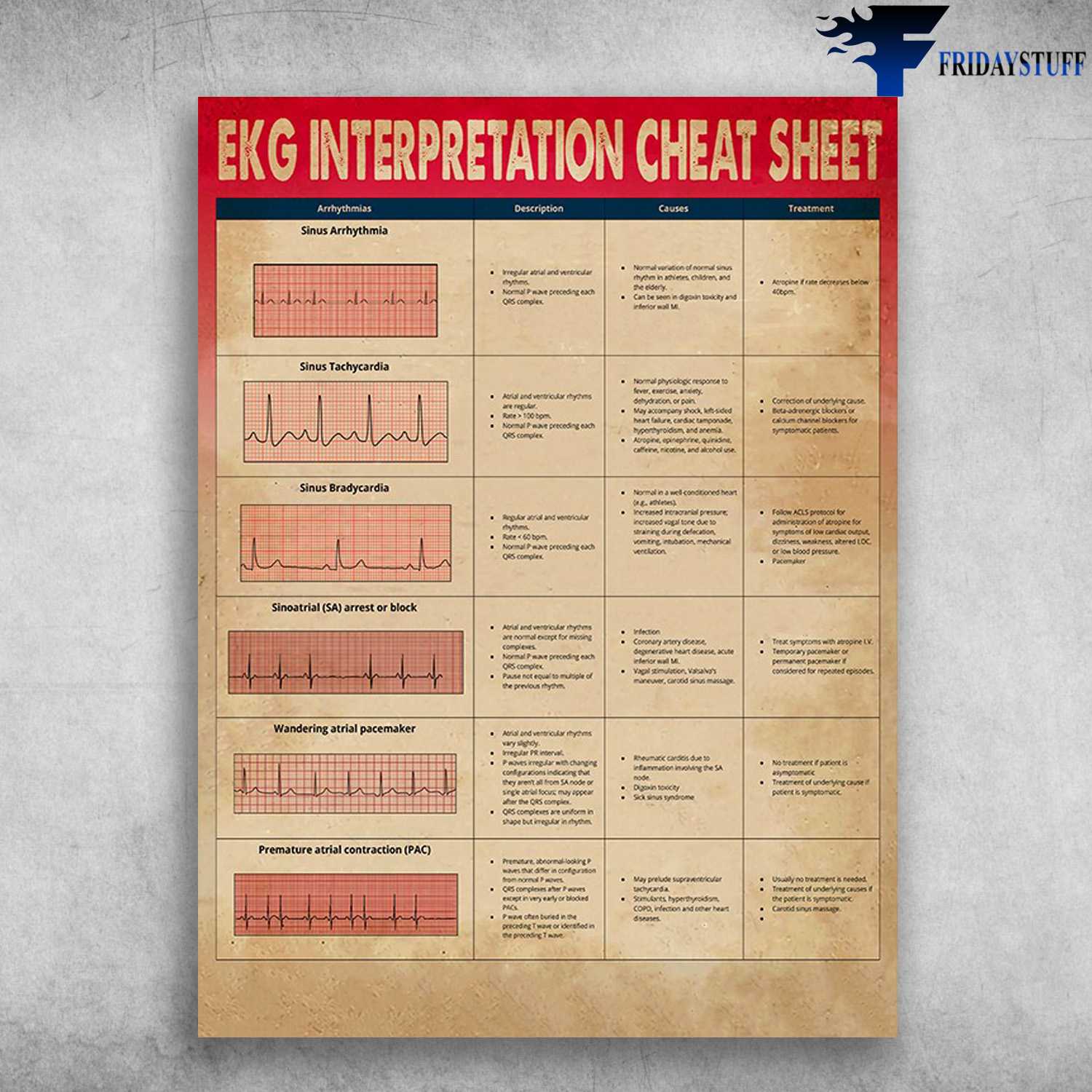 EKG Interpretation Cheat Sheet, Heart Arrhythmias, Sinus Arrhythmia, Sinus Tachycardia, Sinus Bradycardia, Sinoatrical Arrest Or Block