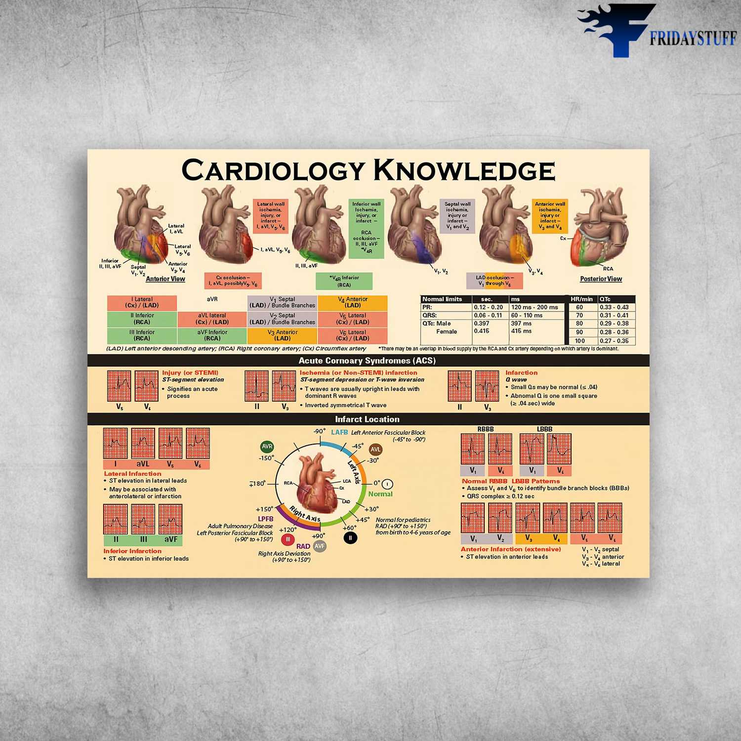 Cardiology Knowledge, Acute Coronary Syndromes, Cardiologist Poster