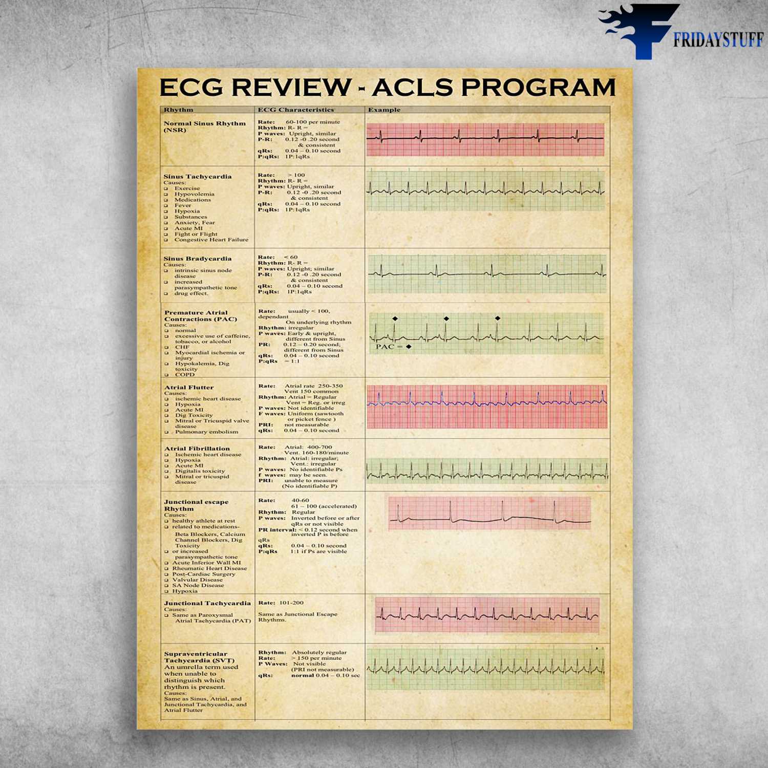 ECG Review - ACLS Program, Electrocardiogram Knowledge, Advanced Cardiovascular Life Support