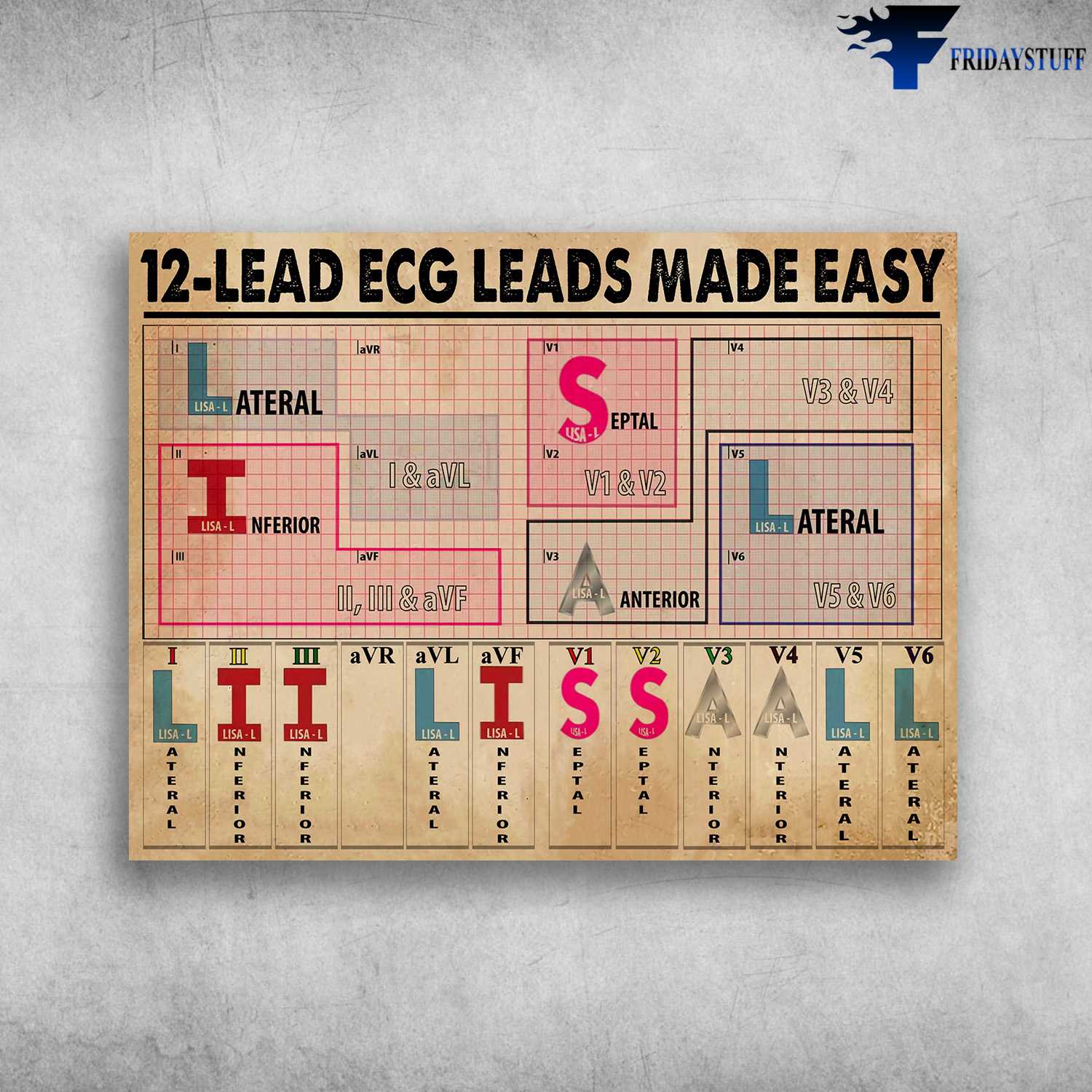 12-Lead Ecg Leads Made Easy, Lateral, Septal, Inferior, Anterior, Lateral