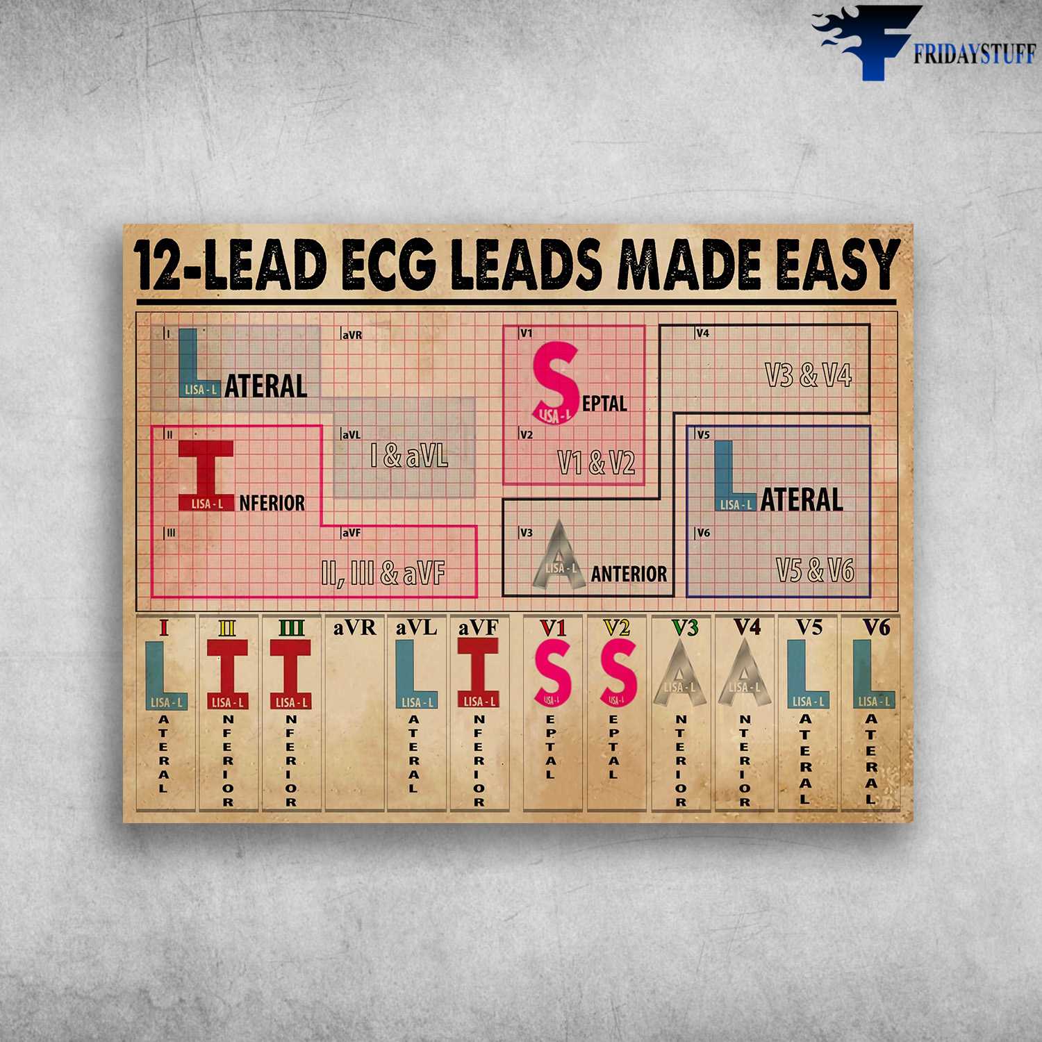 12-Lead Ecg Leads Made Easy, Lateral, Septal, Inferior, Anterior