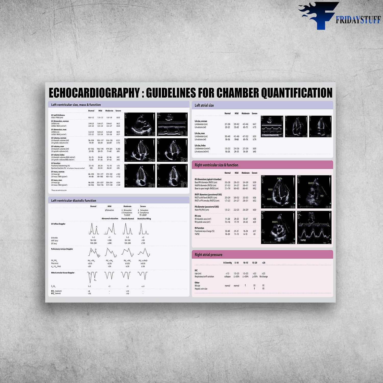Echocardiography Poster, Guidelines For Chamber Quantification, Echocardiography Knowledge